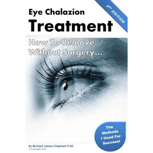 Eye Chalazion: How To Remove Without Surgery: My personal experience and the methods I used for success