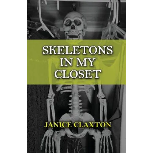 Skeletons in My Closet