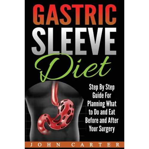 Gastric Sleeve Diet: Step By Step Guide For Planning What to Do and Eat Before and After Your Surgery