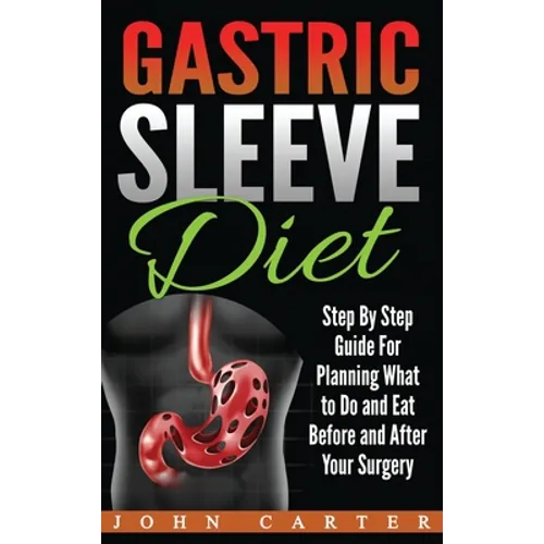 Gastric Sleeve Diet: Step By Step Guide For Planning What to Do and Eat Before and After Your Surgery