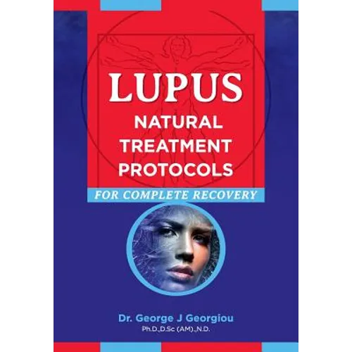 Lupus: Natural Treatment Protocols for Complete Recovery