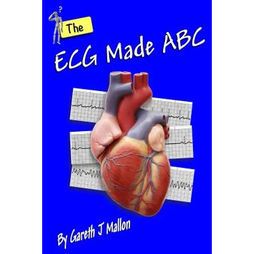 The ECG Made ABC