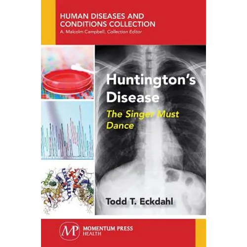 Huntington's Disease: The Singer Must Dance