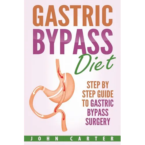 Gastric Bypass Diet: Step By Step Guide to Gastric Bypass Surgery