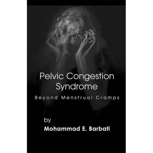 Pelvic Congestion Syndrome - Beyond Menstrual Cramps
