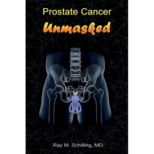 Prostate Cancer Unmasked