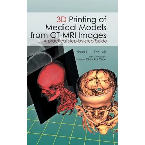 3D Printing of Medical Models from CT-MRI Images: A Practical step-by-step guide
