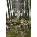 When The Sheep Bite: Loving the Church Even When it Hurts