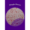 Shingles Disease: The Complete Guide