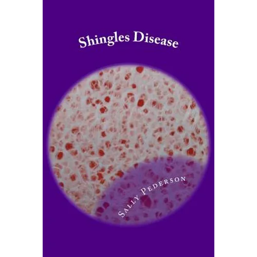 Shingles Disease: The Complete Guide