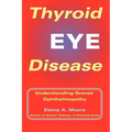 Thyroid Eye Disease: Understanding Graves' Ophthalmopathy