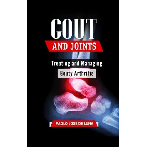Gout and Joints: Treating and Managing Gouty Arthritis