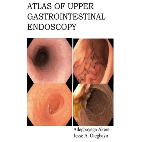 Atlas of Upper Gastrointestinal Endoscopy