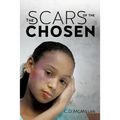 The Scars of the Chosen