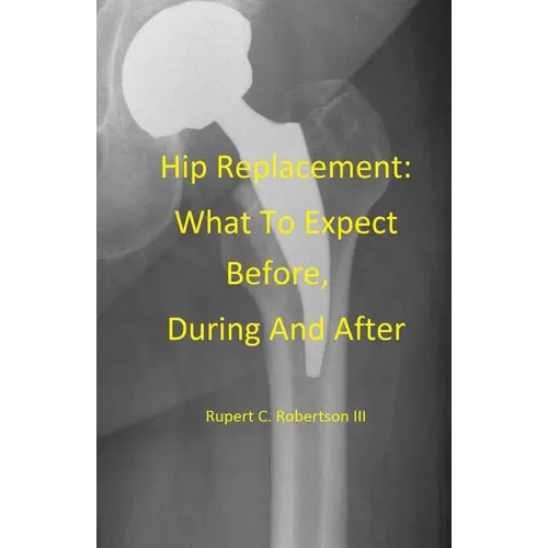 Hip Replacement: What To Expect Before, During and After
