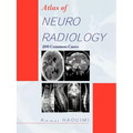 Atlas of Neuroradiology: 200 Common Cases