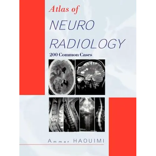 Atlas of Neuroradiology: 200 Common Cases