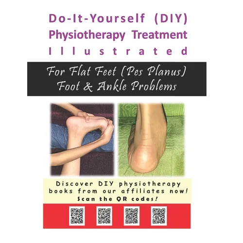 Physiotherapy Treatment Illustrated For Flat Feet (Pes Planus) Foot & Ankle Problems