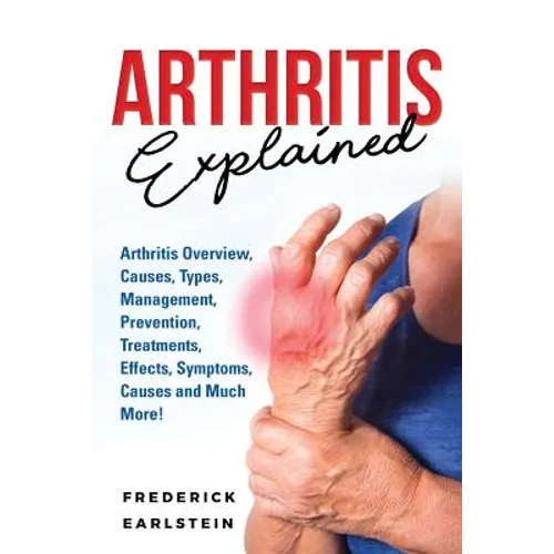 Arthritis Explained: Arthritis Overview, Causes, Types, Management, Prevention, Treatments, Effects, Symptoms, Causes and Much More!
