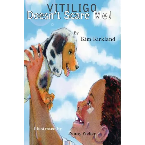 Vitiligo Doesn't Scare Me