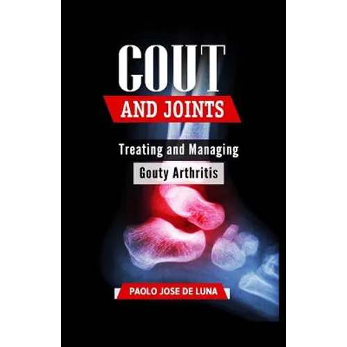 Gout And Joints: Treating and Managing Gouty Arthritis