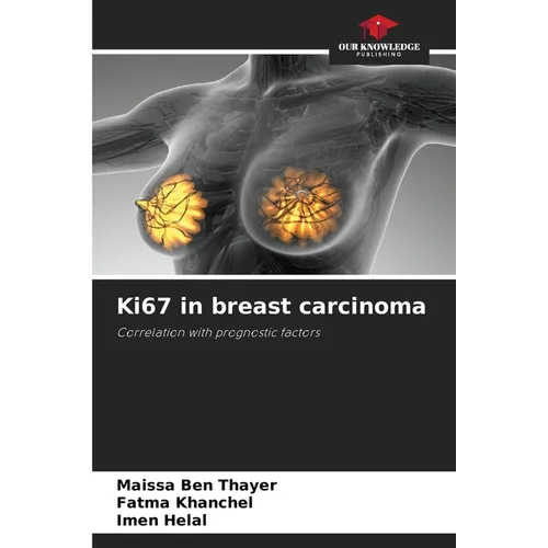 Ki67 in breast carcinoma