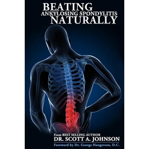 Beating Ankylosing Spondylitis Naturally