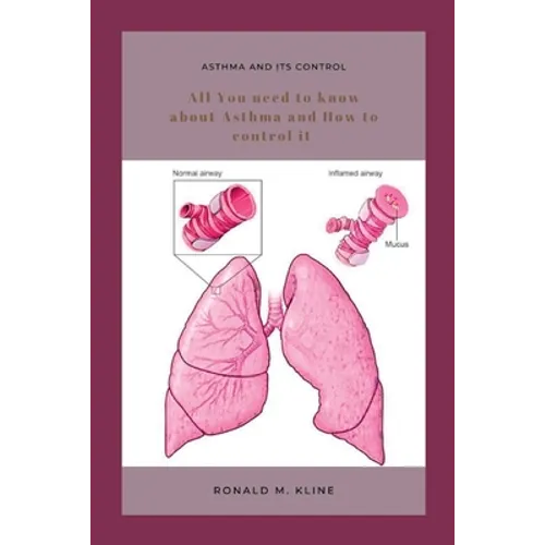 Asthma and its control: All you need to know about Asthma and how to control it.