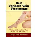 Best Varicose Vein Treatments: Natural Remedies That Work for Varicose