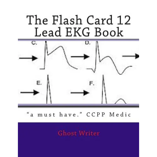 The Flash Card 12 Lead EKG