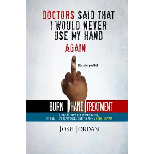 Burn Hand Treatment: A How-To Guide for Rehabilitation with Real Life Experiences from a Burn Survivor