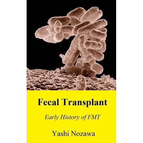 Fecal Transplant: Early History of FMT