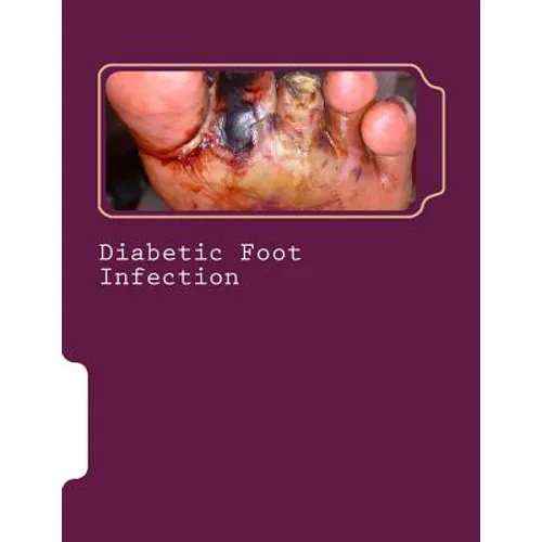 Diabetic Foot Infection