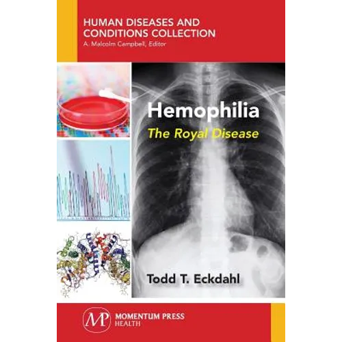 Hemophilia: The Royal Disease
